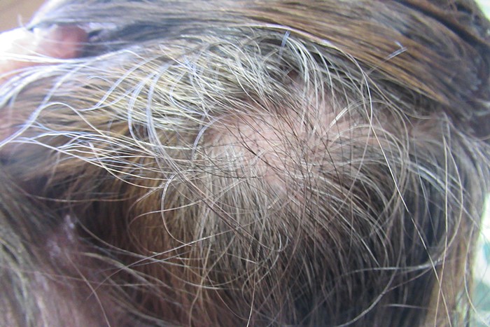 白髪染をする前の後頭部の写真