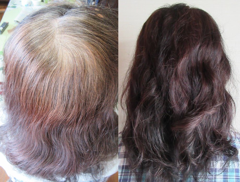 マイナチュレヘアカラートリートメントを使って白髪を染める前と後の髪の毛の写真